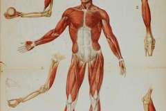 Трофическая язва