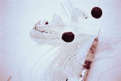 Последние разработки в лечении межпозвоночной грыжи